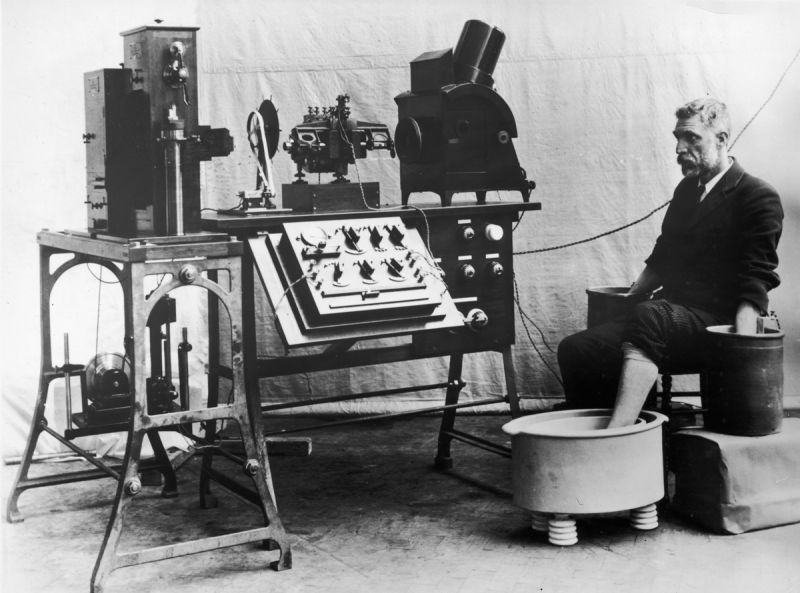 First Electrocardiogram